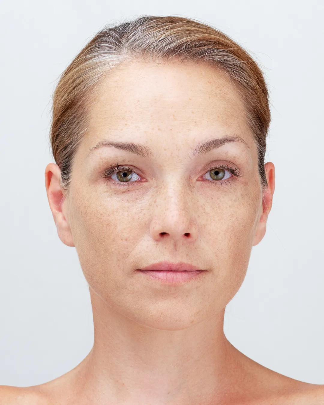 Skin Concern Pigmentation 2