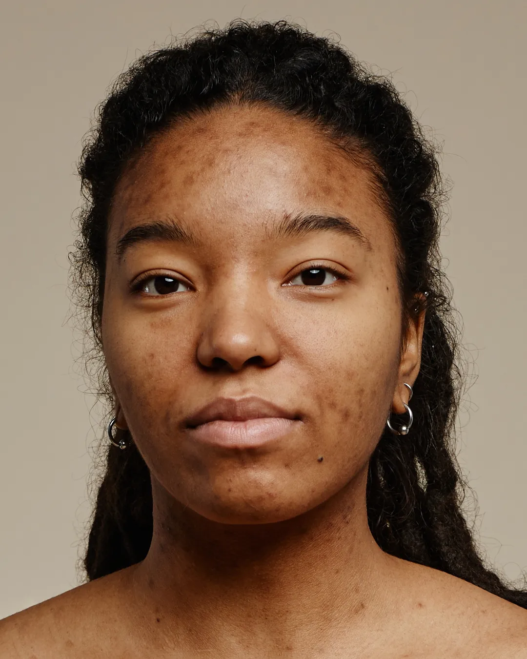 Skin Concern Scarring 2