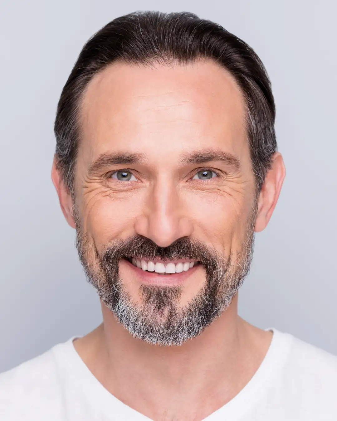 Skin Concern Hair-Loss 2