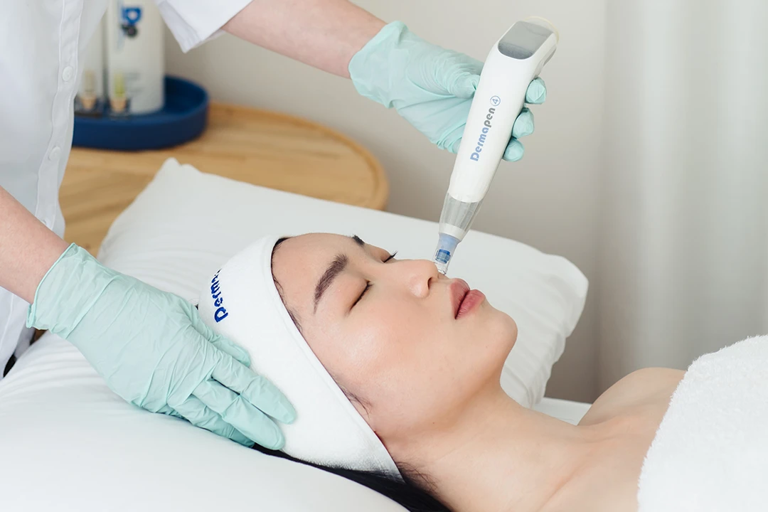 What Is Dermapen Microneedling