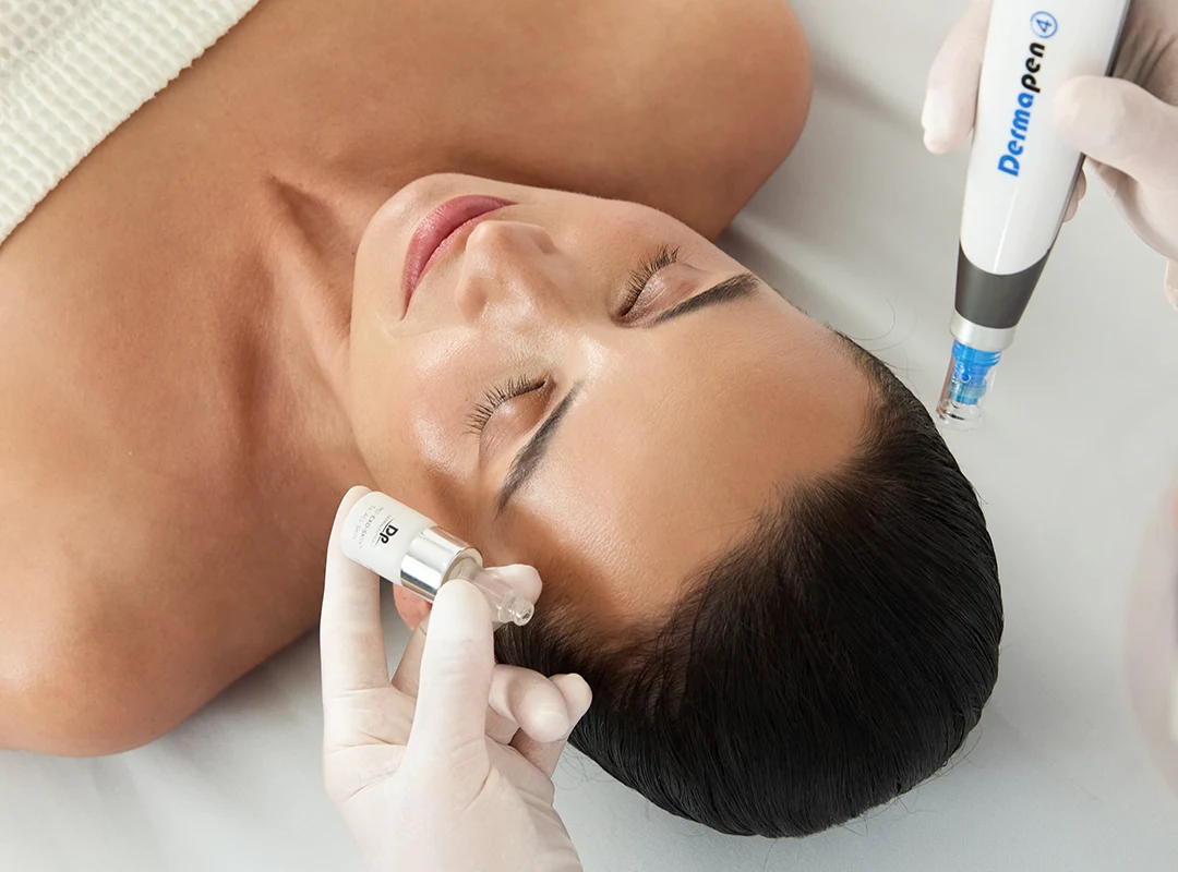 Image Dermapen 4 Refresh Non Negotiables Horizontal