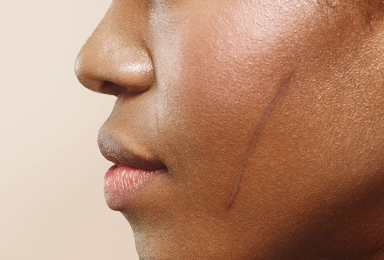 Skin-Concerns-Scars Homepage