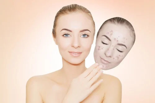 Microneedling-Before-And-After-Results-To-Watch-Out-For