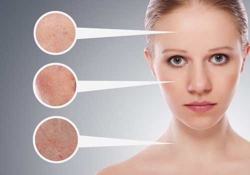 Heres-How-Dermapen-Works-In-Treating-Common-Skin-Woes