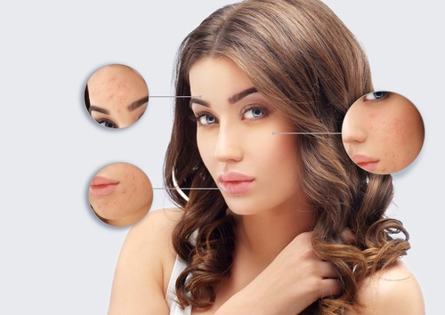 The-4-Best-Skin-Needling-Benefits