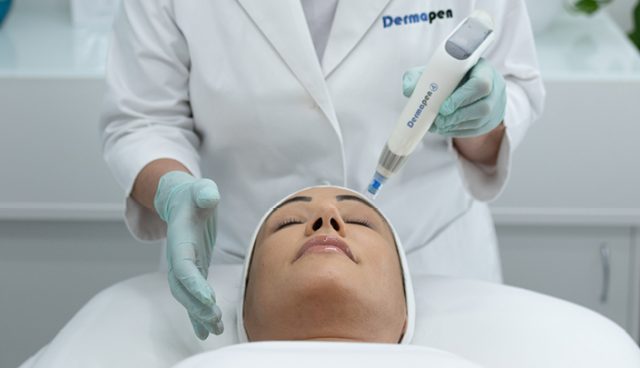 How Often To Microneedle-640x368