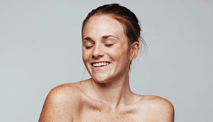Skin Pigmentation