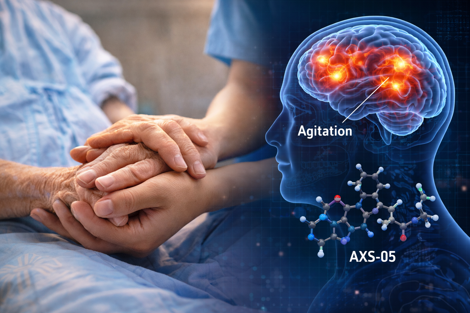 FDA grants priority review for Axsome's AXS-05 in Alzheimer's | Grafa