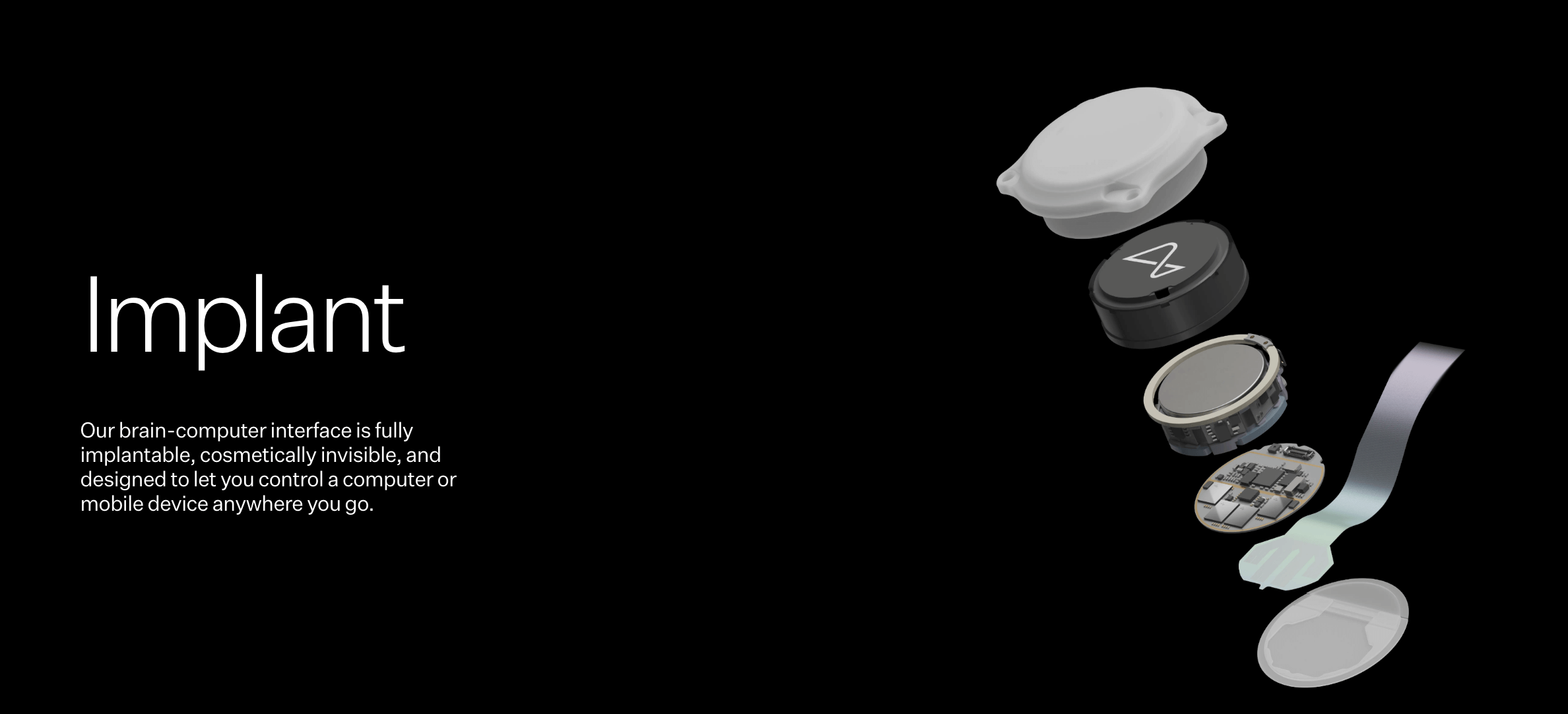The brain chip, approximately the size of a quarter, records and transmits brain activity through ultra-thin threads, totaling 64, each housing over a thousand electrodes. 
