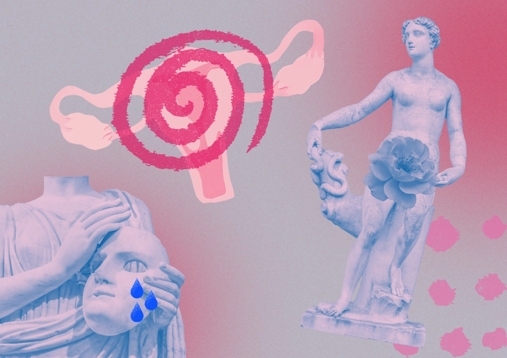 PCOS Polycystic Ovary Syndrome