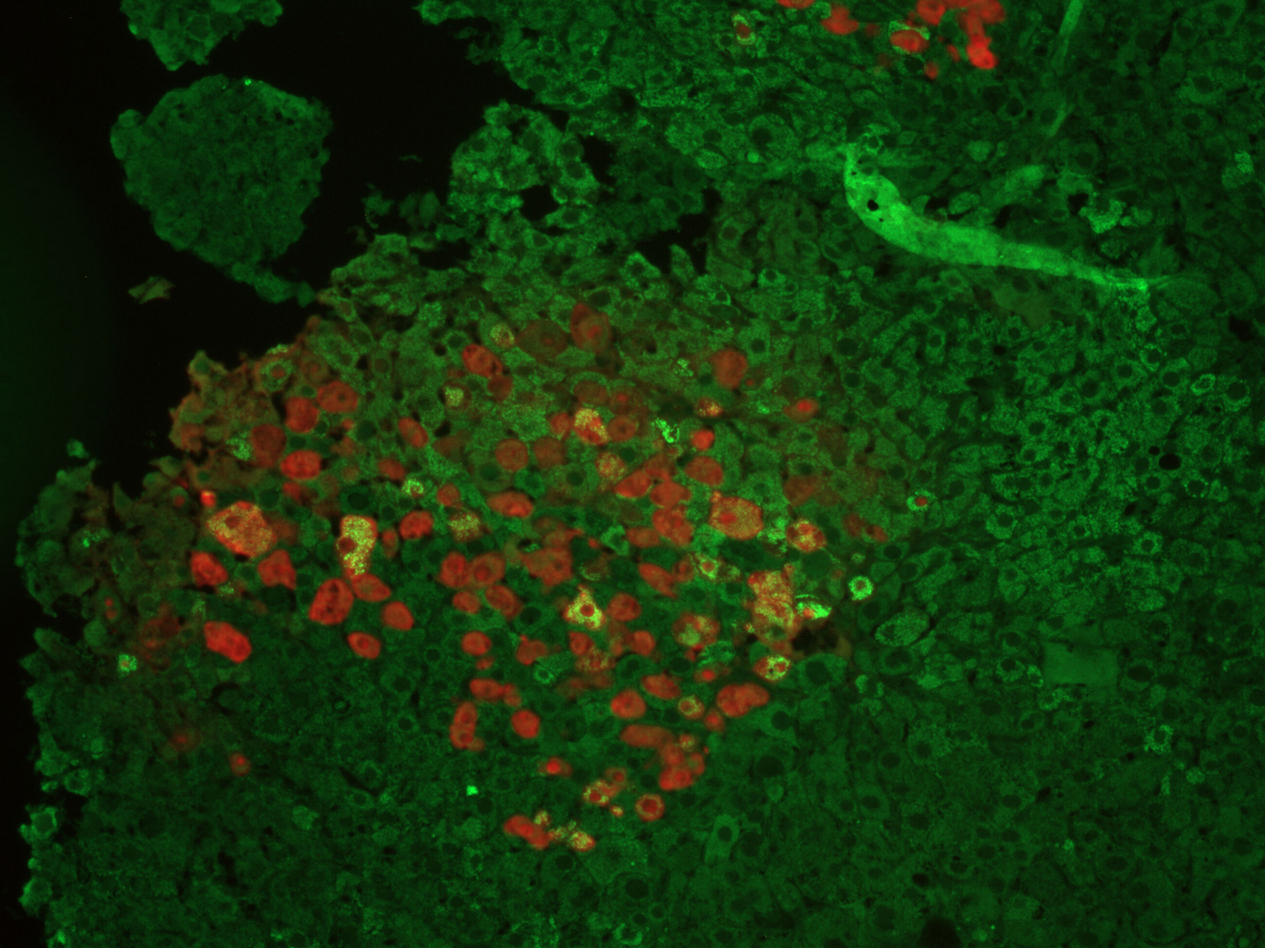 Liver image 2