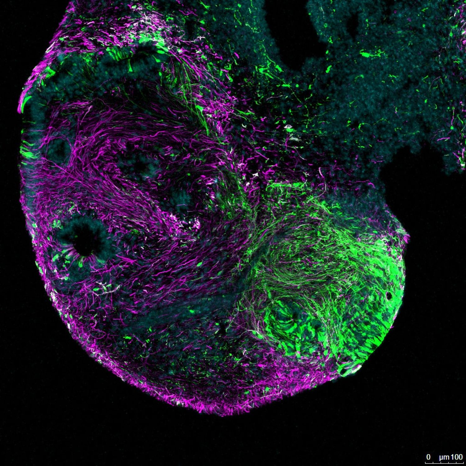 Lancaster AA Vpromoters