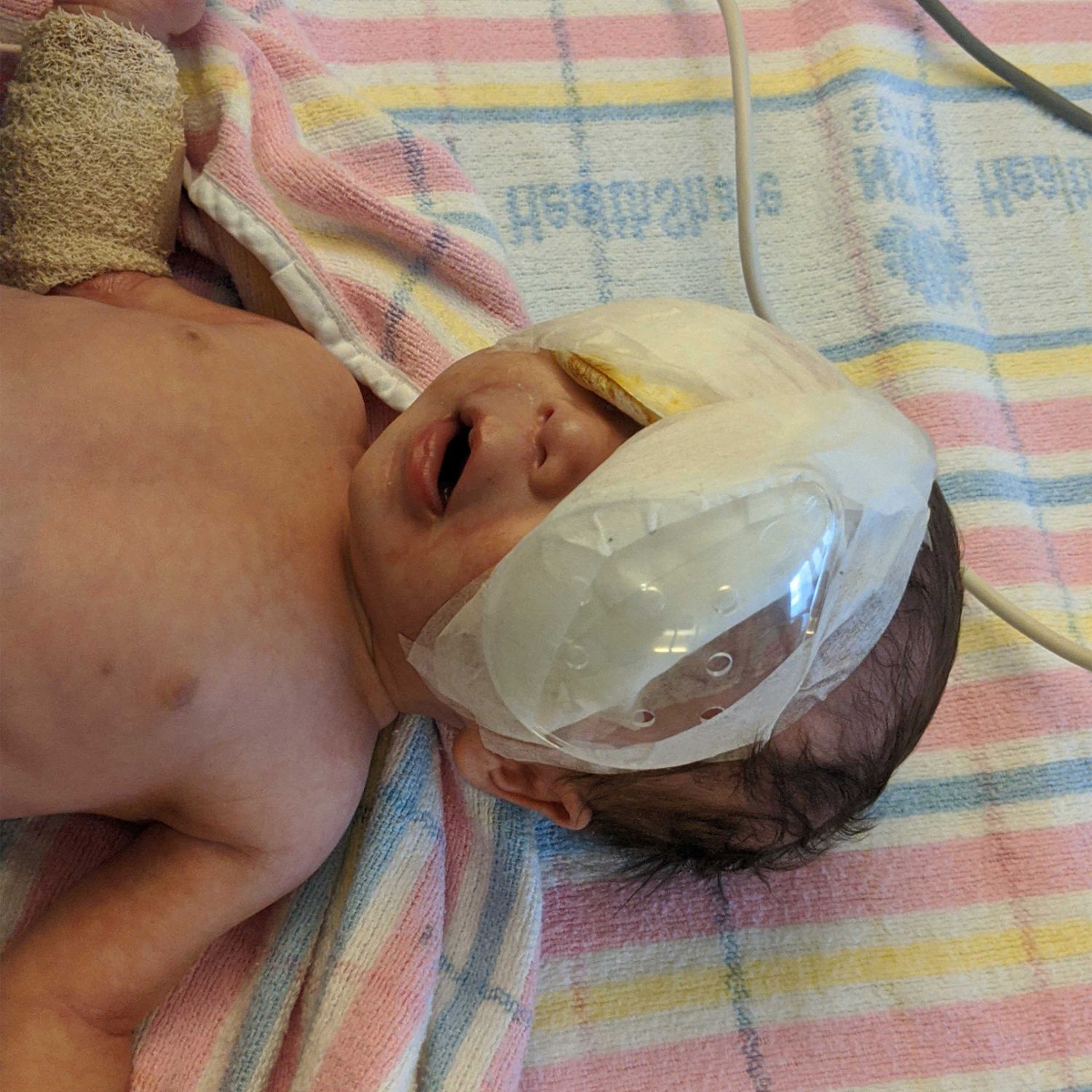 James Homewood Baby post surgery april 2020 resized