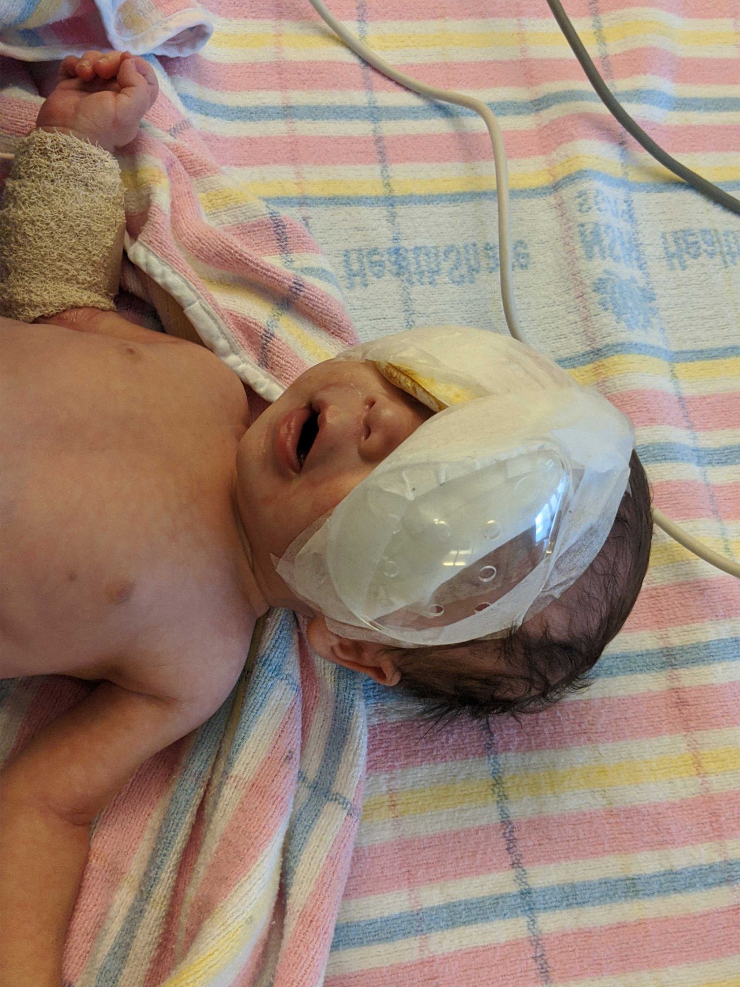 James Homewood Baby post surgery april 2020 resized