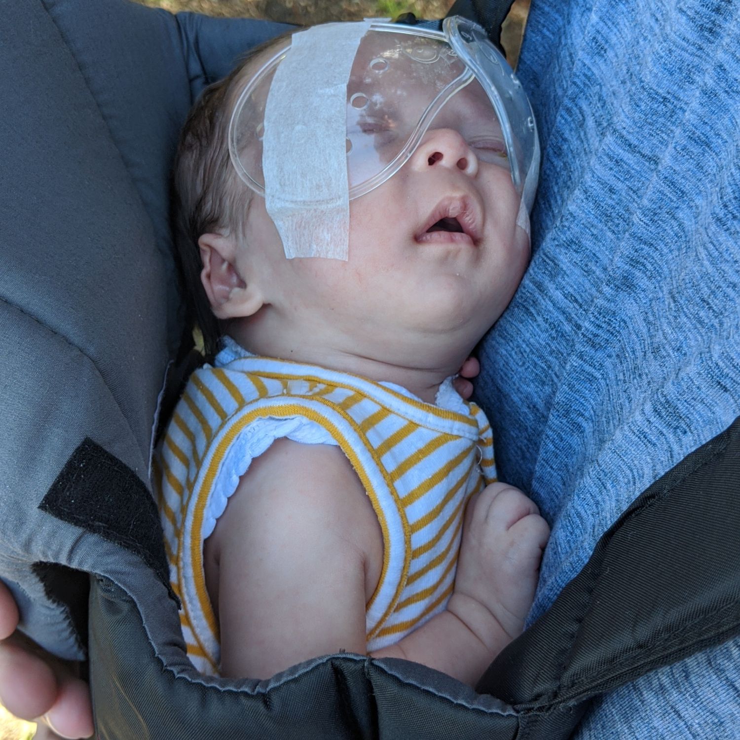 James Homewood Baby 2020 post 1st surgery