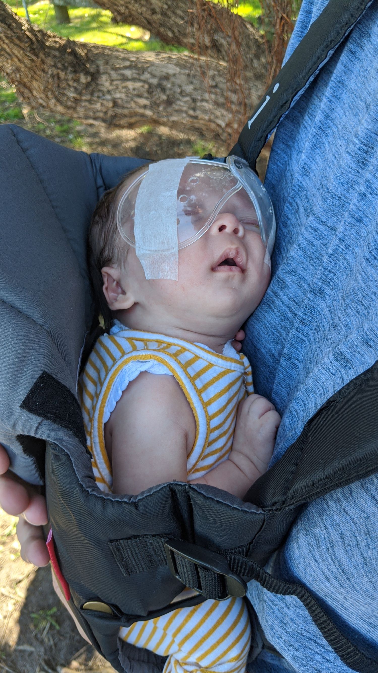 James Homewood Baby 2020 post 1st surgery