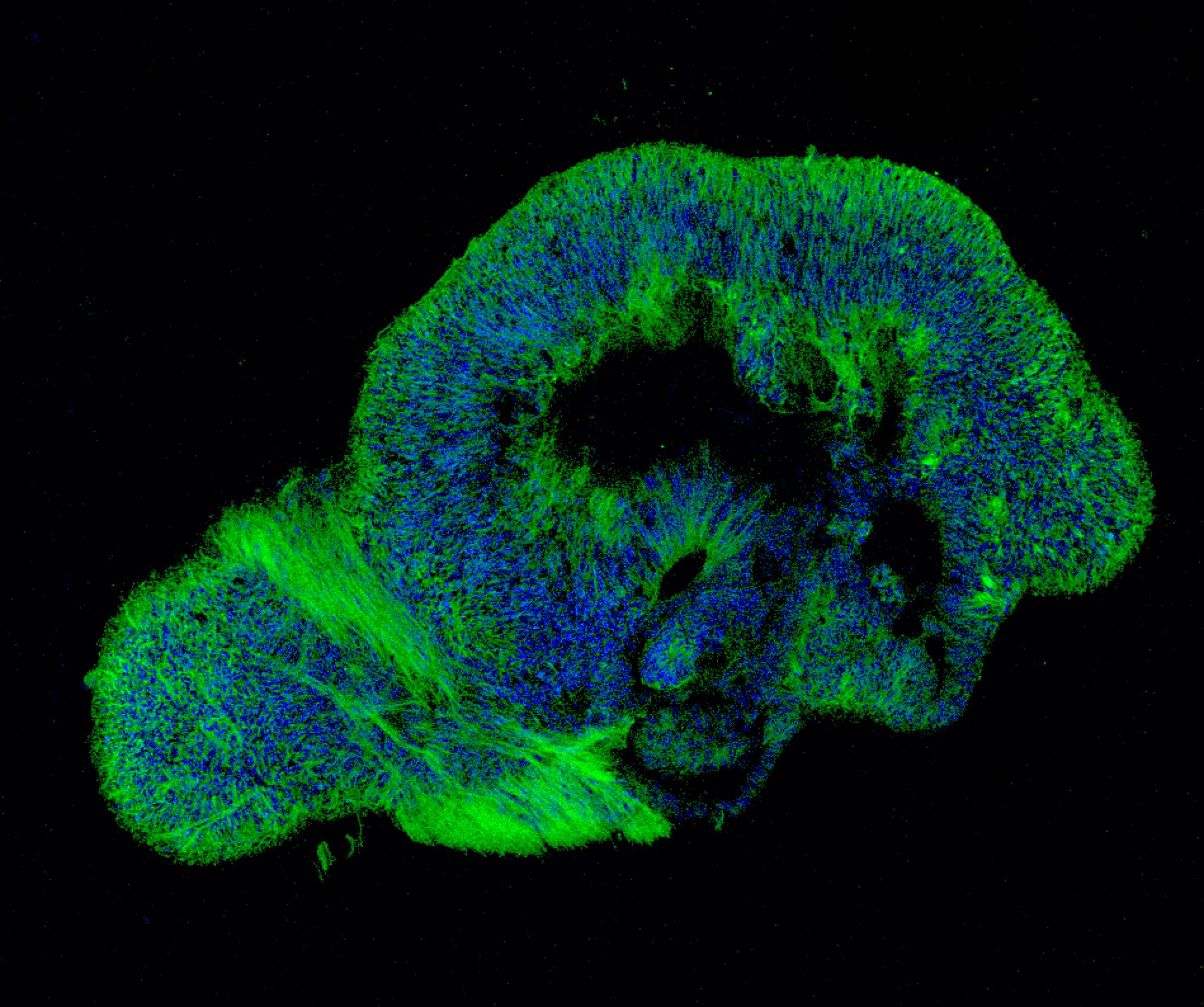 Retinal Organoid copy