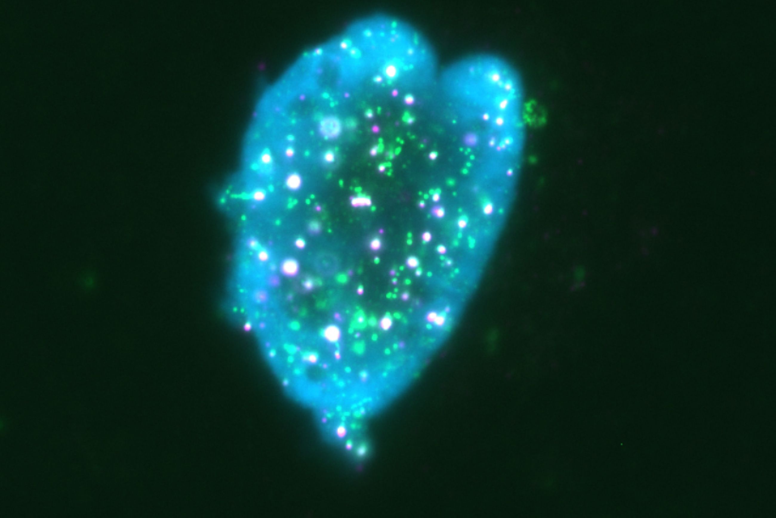 18 Jessie Zhang Nunki ALT associated promye LOV Eitic bodies