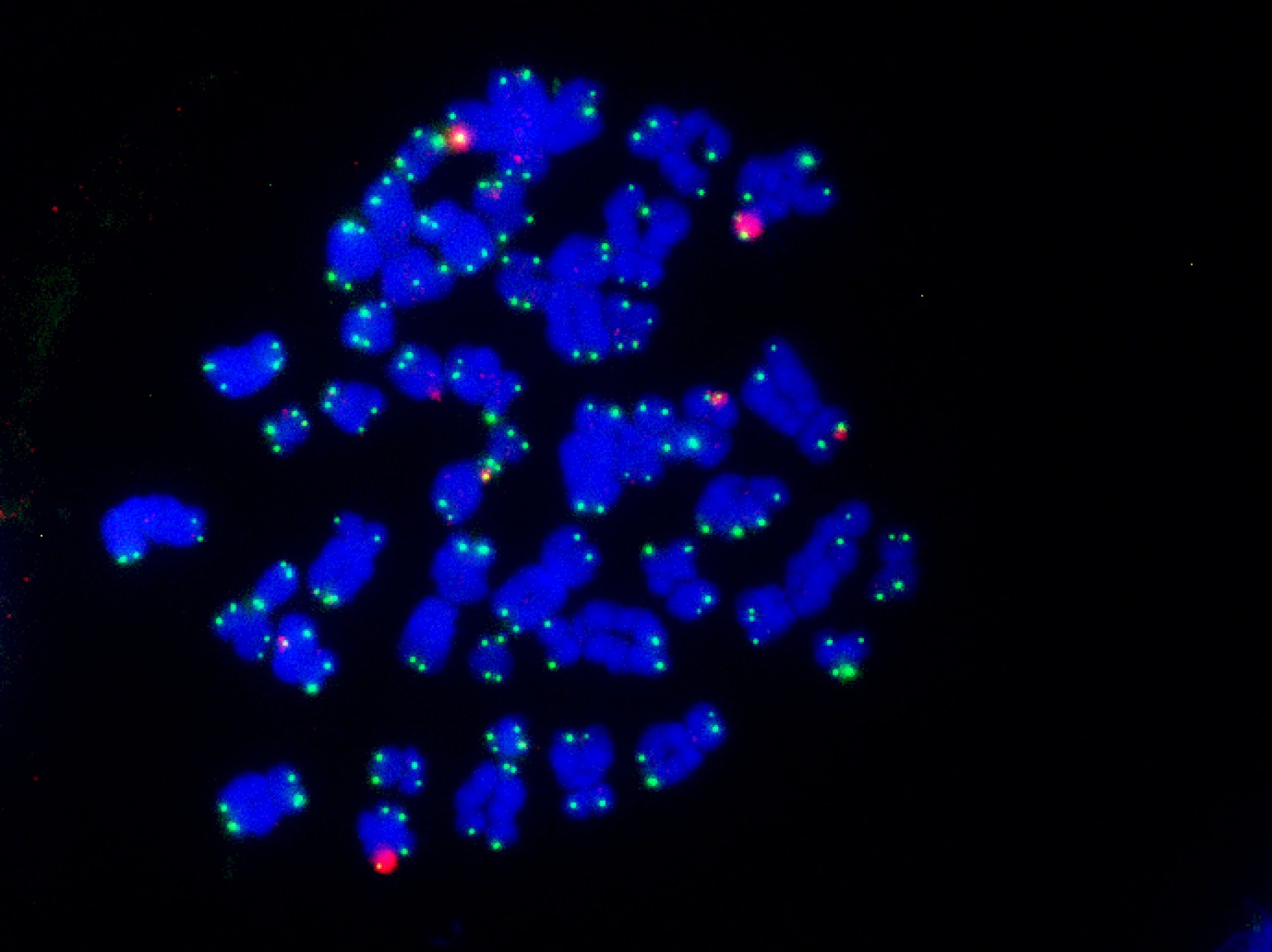 20 Omesha meta TI Fs