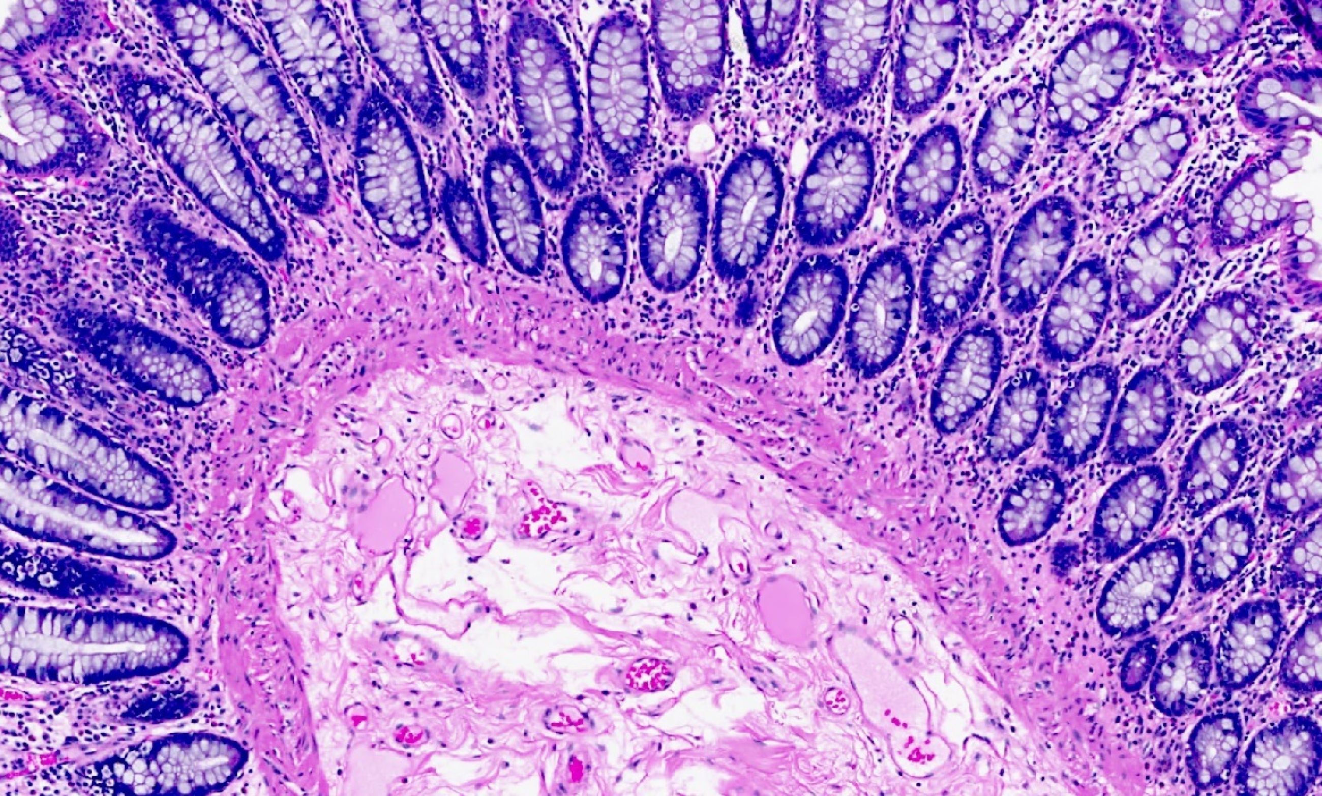 Procan histopathology