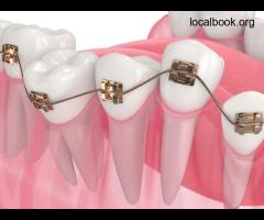 Dental Crowns Bella Vista - 2