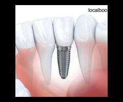 Dental Implant Cost Canberra
