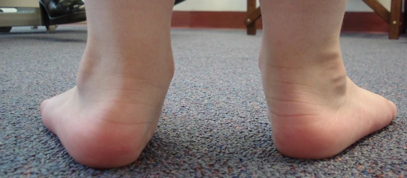 are jordans good for flat feet