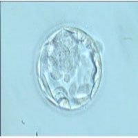 Fecundación in Vitro (FIV) cover