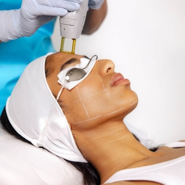 Laser Hair Removal - Face - Full