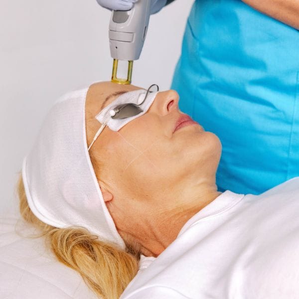 Laser for Skin Rejuvenation - Decolletage