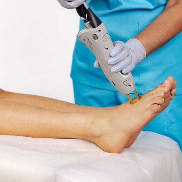 Laser Hair Removal Add-On - Feet+Toes