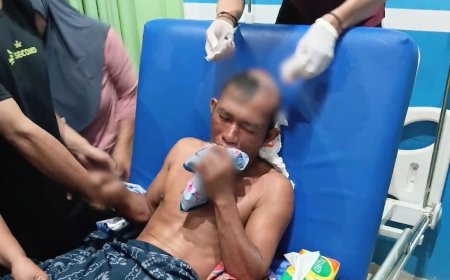 Tabrak Lari di Perairan Bungku: Nelayan Bahontobungku Terluka, Kapal Misterius Melarikan Diri
