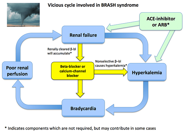 File:Brash syndrome.png
