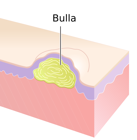 File:Bulla.png