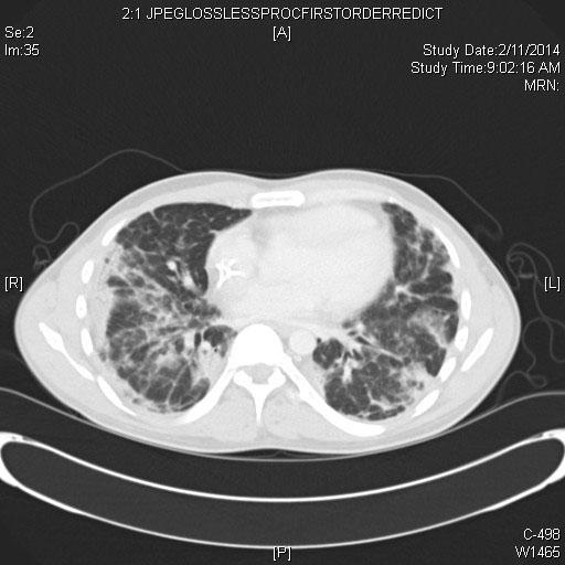 File:COVID one pager with links 2.jpg
