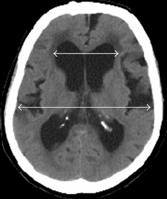 FileCT of Evan's index.jpg WikEM