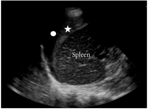 File:Free fluid 3.png