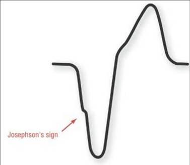 File:Josephson’s sign.jpg