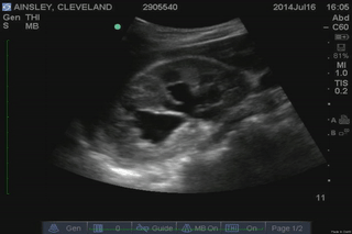 File:Moderate hydro - 1.gif