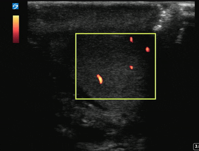 File:Normal testicular flow.gif
