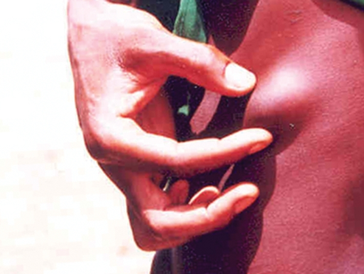 File:PMC2041822 pntd.0000074.g001.png