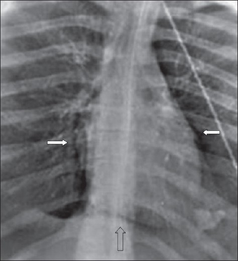 File:PMC2700481 ATM-04-75-g032.png