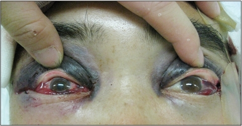 File:PMC2992570 kjo-24-380-g001.png