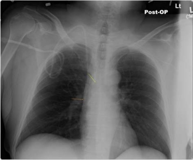 File:PMC3270925 rmhp-4-027f1.png