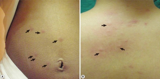 File:PMC3309057 kjp-50-79-g001.png