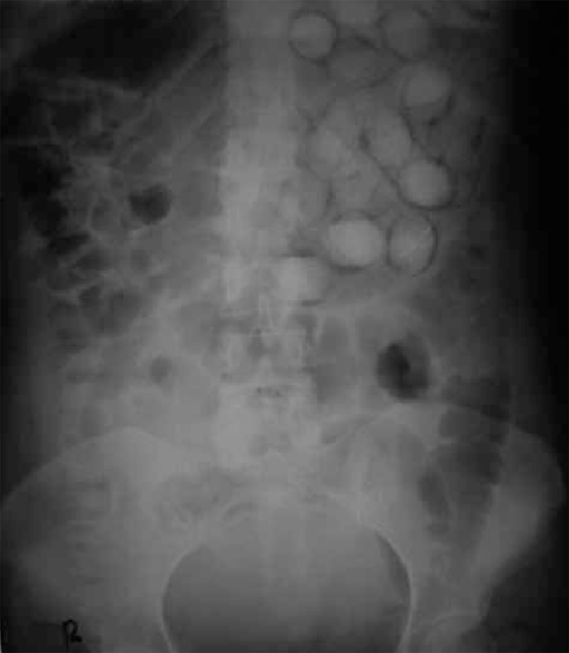 File:PMC3522363 iranjradiol-08-205-g002.png