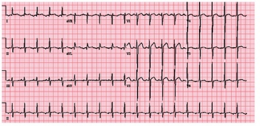 File:PMC3665213 CRIM.MEDICINE2013-430862.002.png