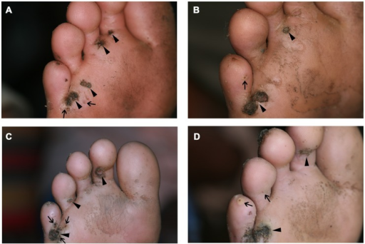 File:PMC3777867 pntd.0002426.g006.png