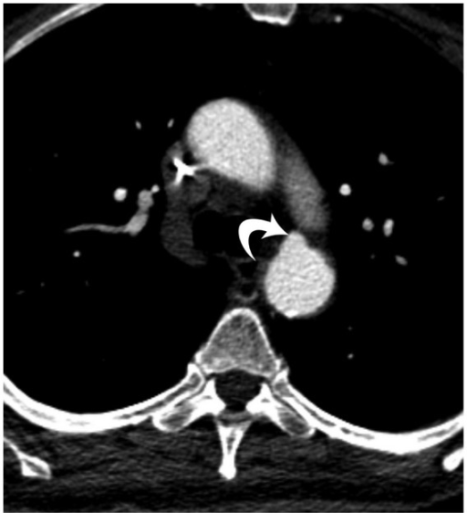 File:PMC3874367 IJVM2013-797189.010.png