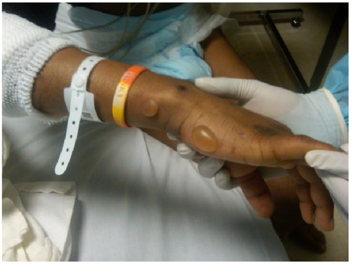 File:PMC4251093 CRIE2014-862912.001.png